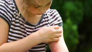 Pokud jste byli bitováni tipy osa a pravidly první pomoci