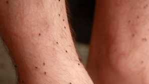 Jaké sny o blechách jsou význam snů, jak správně rozluštit spánek