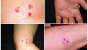 Interpretace interpretace krysy snů