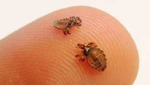 Druhy popisu vši, vlastnosti, vzhled, funkce